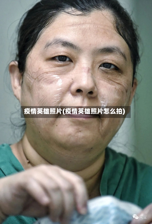 疫情英雄照片(疫情英雄照片怎么拍)